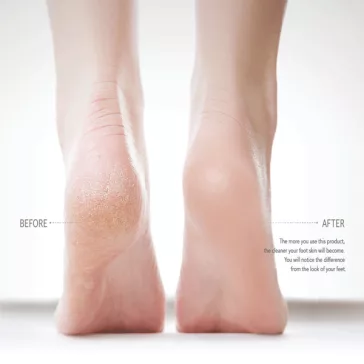   ALPHA OPTRON Magic Pedi mágikus üveg sarokreszelő - Pioneer