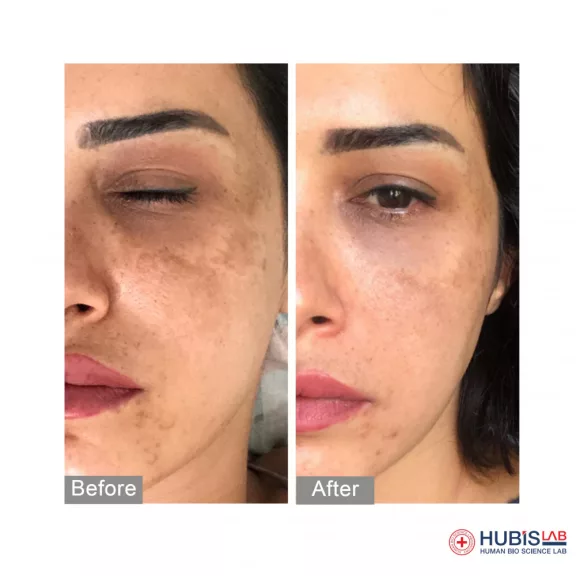 HUBISLAB Derma Max Brilliance Cream