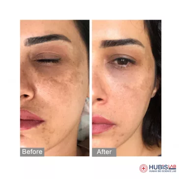 Hubislab Derma Max brightening serum