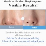 MEDICUBE Zero Pore pórusszabályzó tonikkal átitatott korong bőrápoló összetevőkkel